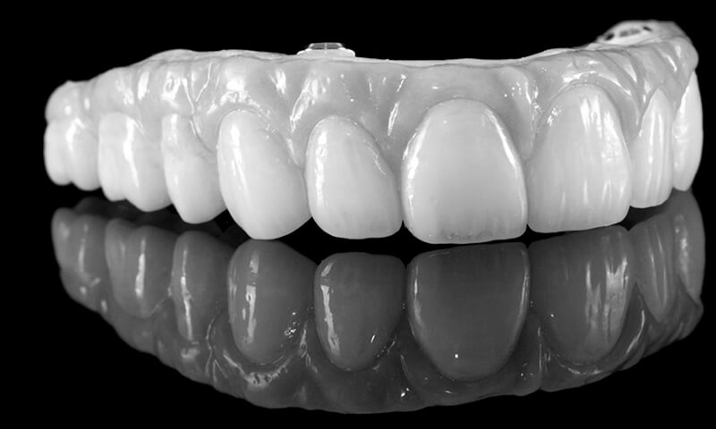 A dentadura fixa em porcelana sobre zircônia é o tipo que traz os melhores resultados estéticos.